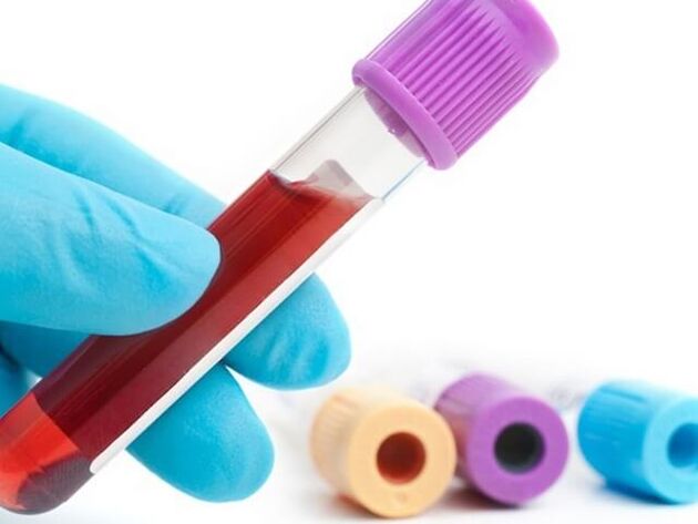 Metody laboratoryjne